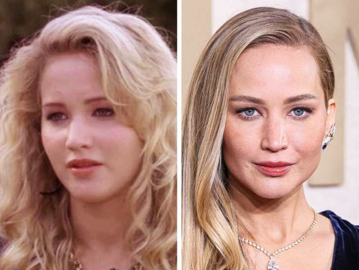 14 Celebrities Who Achieved Chiseled Cheekbones and Drastically Altered Their Looks