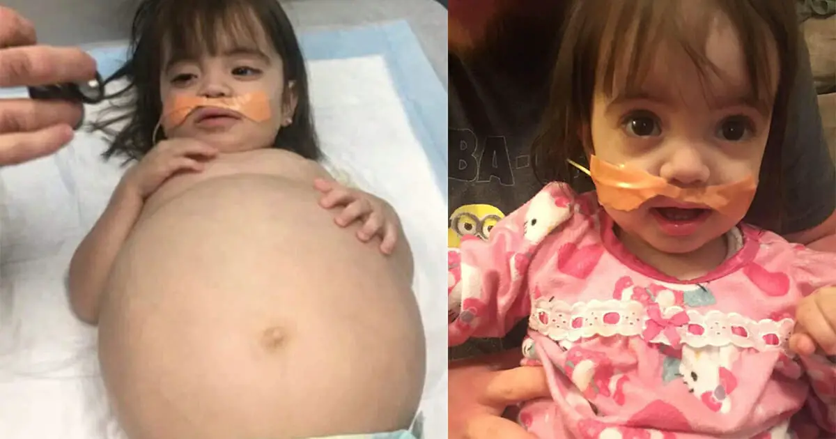 Baby girl looks 8 months pregnant - then shocking cause is revealed and dad steps in